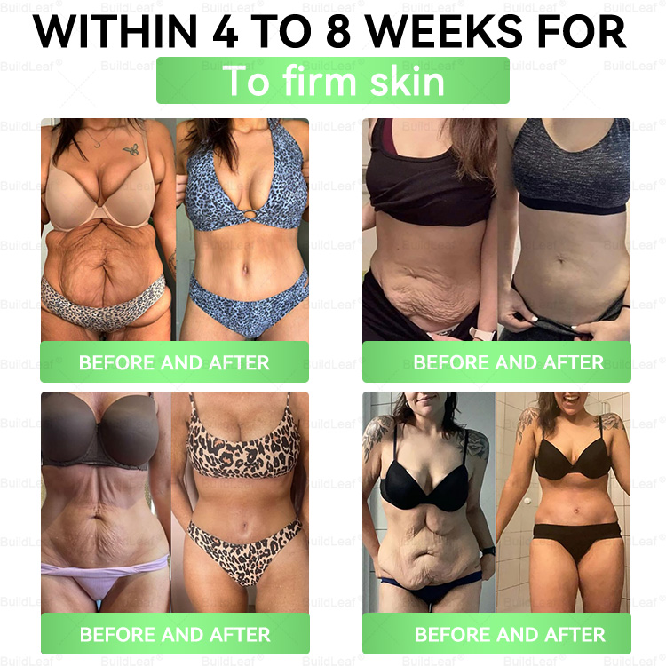 ๐ฅ๐๐ฉ๐๐ข๐๐
๐ณ๐๐๐ยฎ Only 5 Boxes!!!!! Grab an exclusive 50% discount now! Keep you healthy and improving in just 1 to 4 weeks. Donโt miss your chanceโthis offer wonโt come around again until next year. Act fast! 180-day money back guarantee!