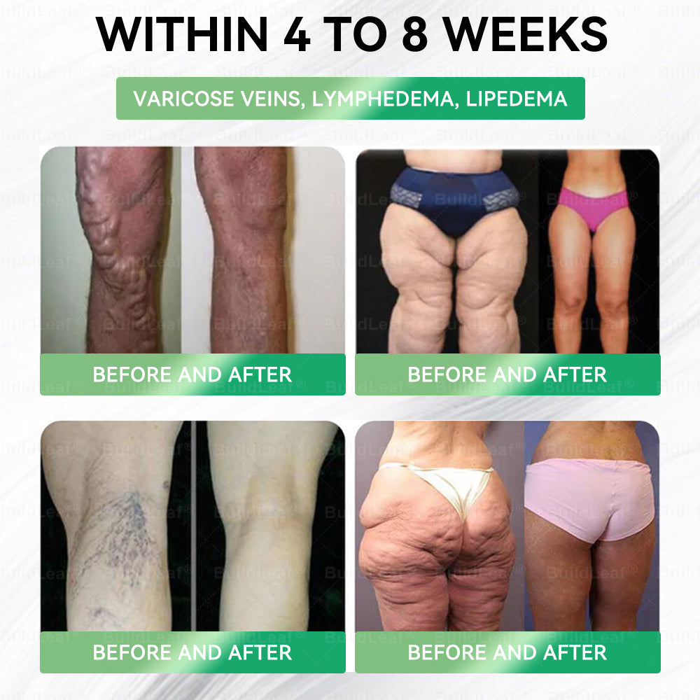 ๐ฅ๐๐ฉ๐๐ข๐๐
๐ณ๐๐๐ยฎ Only 5 Boxes!!!!! Grab an exclusive 50% discount now! Keep you healthy and improving in just 1 to 4 weeks. Donโt miss your chanceโthis offer wonโt come around again until next year. Act fast! 180-day money back guarantee!