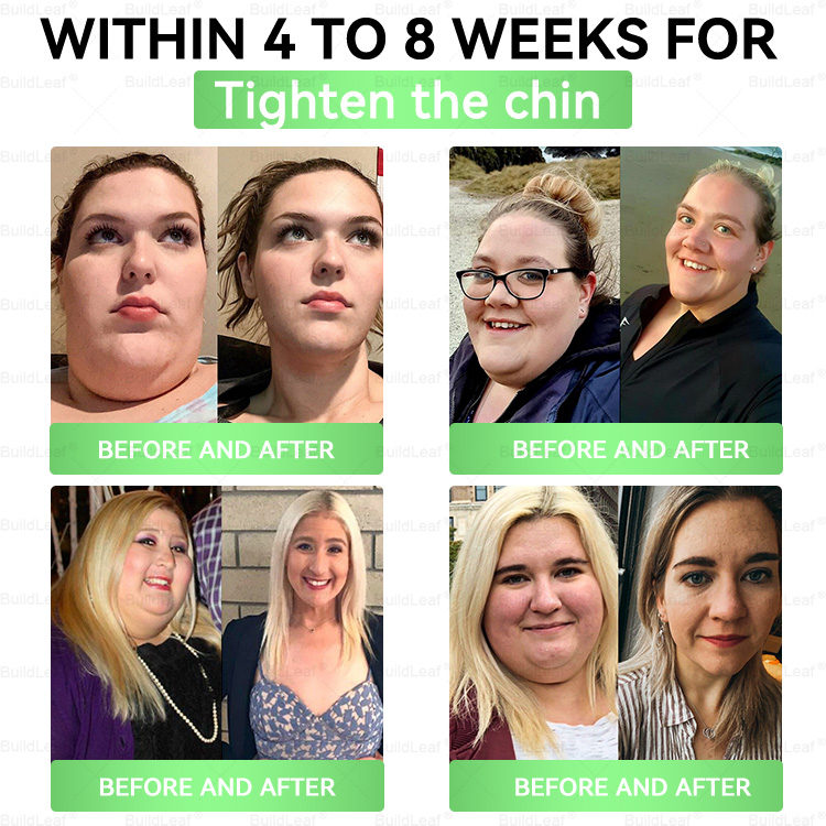 🔥🍀𝑩𝒖𝐢𝒍𝒅𝑳𝒆𝐚𝒇® Only 5 Boxes!!!!! Grab an exclusive 50% discount now! Keep you healthy and improving in just 1 to 4 weeks. Don’t miss your chance—this offer won’t come around again until next year. Act fast! 180-day money back guarantee!